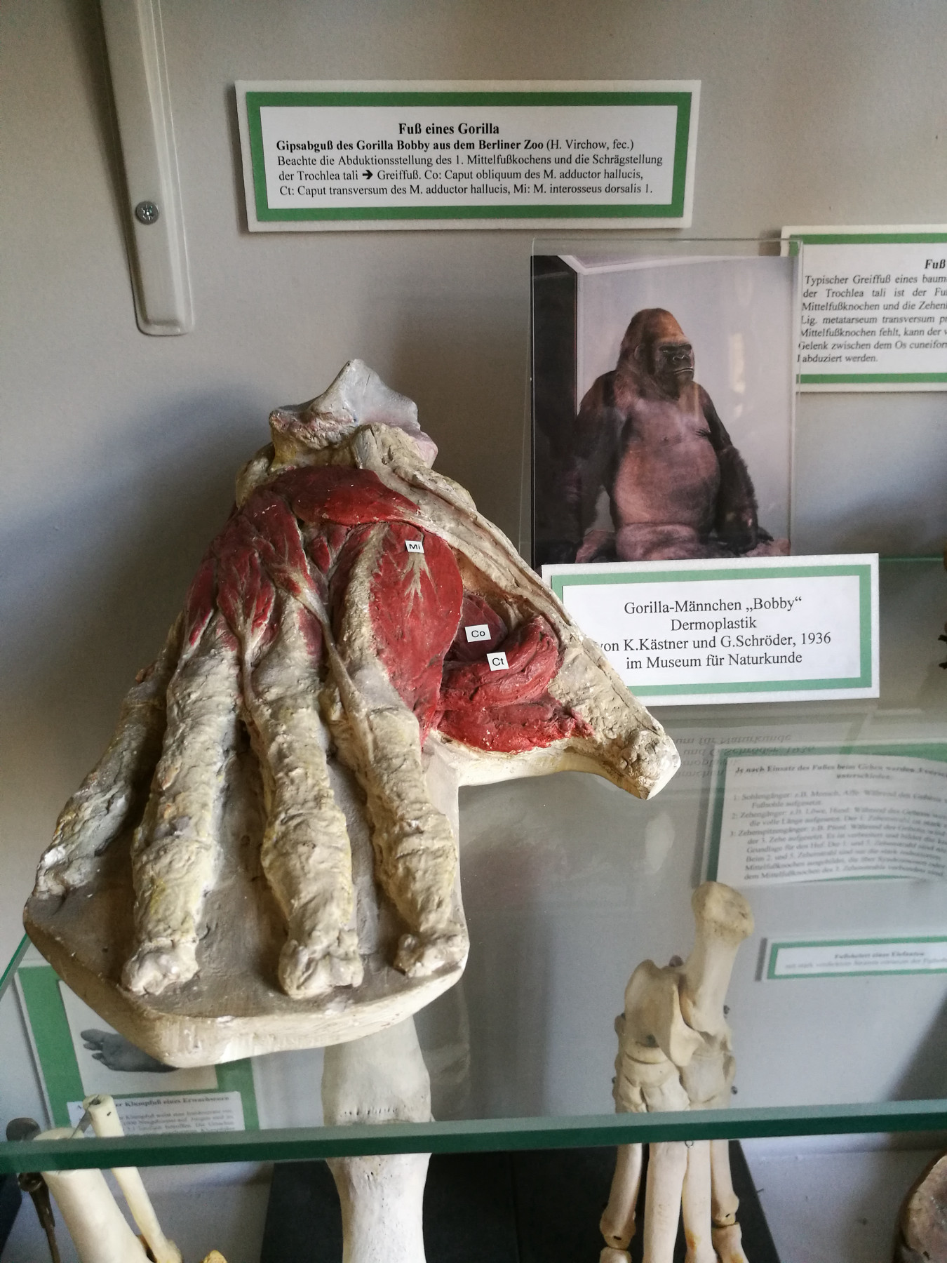 This photo shows a cast of a gorilla foot with the muscles exposed and coloured in a glass display case, beneath it bone sections from other extremities. Behind the plaster foot is a colour photo of "Bobby" the gorilla together with a number of labels with writing on them.